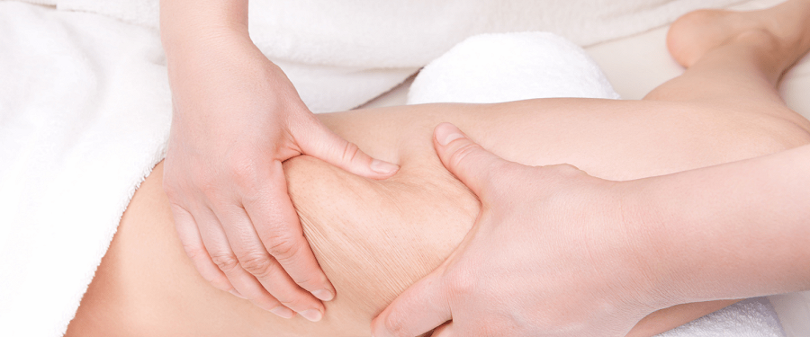 Gel reductor Kefus ¡Indispensable para eliminar la grasa!